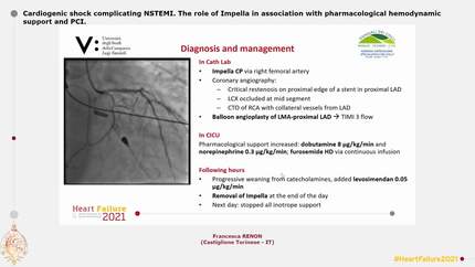 Cardiogenic shock complicating NSTEMI. The role of Impella in association with pharmacological hemodynamic support and PCI.