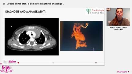 Double aortic arch: a pediatric diagnostic challenge
.