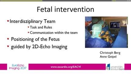 Presentation thumbnail