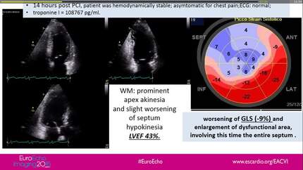 Presentation thumbnail