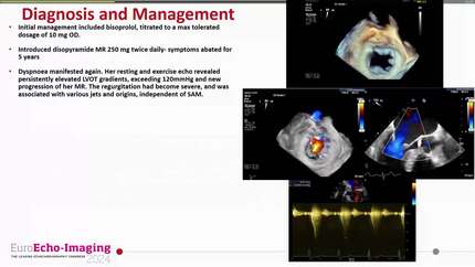 Complex mitral cleft anatomy in a case of HCM: addressing multifactorial MR and the role of myosin inhibition