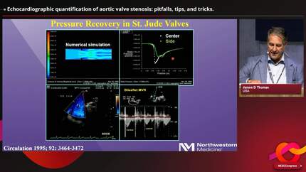 Echocardiographic quantification of valvular heart disease: a cookbook approach