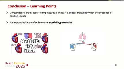 From fix to fallout: late pulmonary hypertension post aortic coarctation correction and patent ductus arteriosus closure