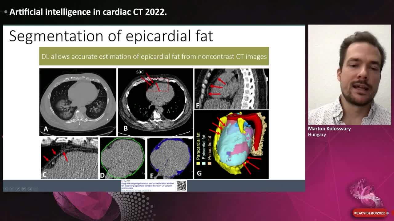 Artificial intelligence and cardiovascular imaging in 2022