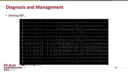 Presentation thumbnail