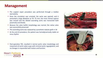 Limited aortic intimal tear- Break the vicious cycle