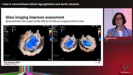Clinical Case Management: the diagnostic challenge of combined valvular stenosis and regurgitation