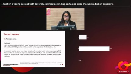 TAVR in a young patient with severely calcified ascending aorta and prior thoracic radiation exposure.
