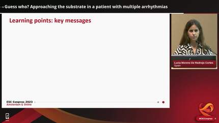 Ventricular arrhythmias 