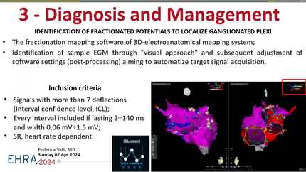 Cardioneuroablation: a clinical case.