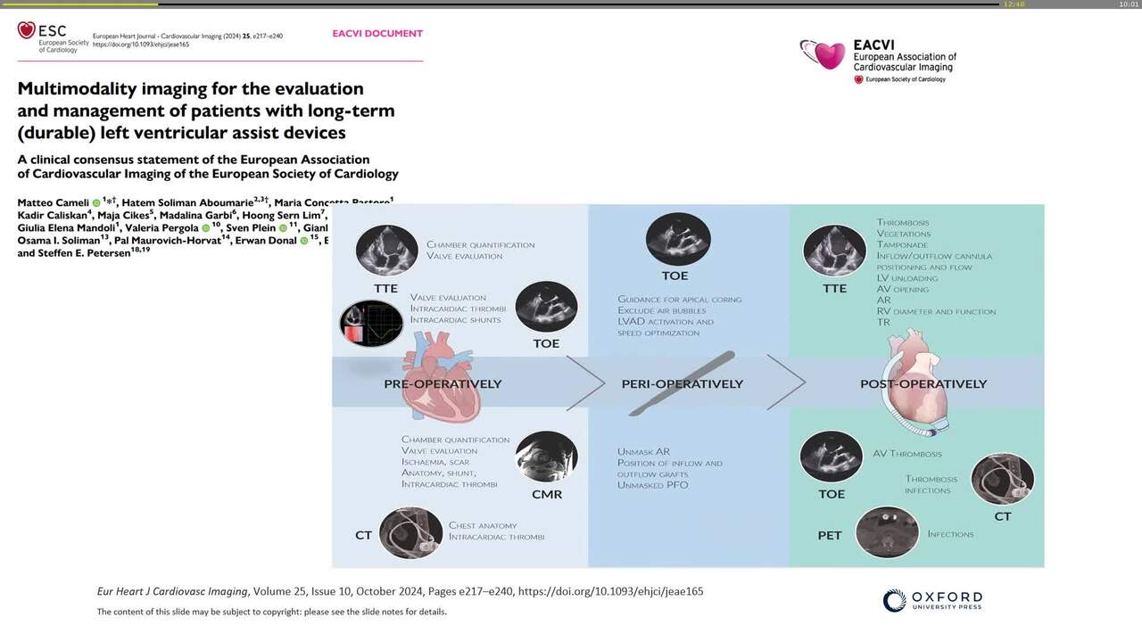 Role of echocardiography in advanced heart failure and mechanical circulatory support 