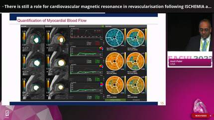There is still a role for cardiovascular magnetic resonance in revascularisation following ISCHEMIA and REVIVED - PRO
