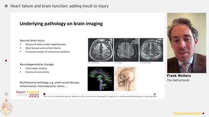 Presentation thumbnail