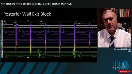 New solutions for old challenges: endo/epicardial ablation of AF / AT.