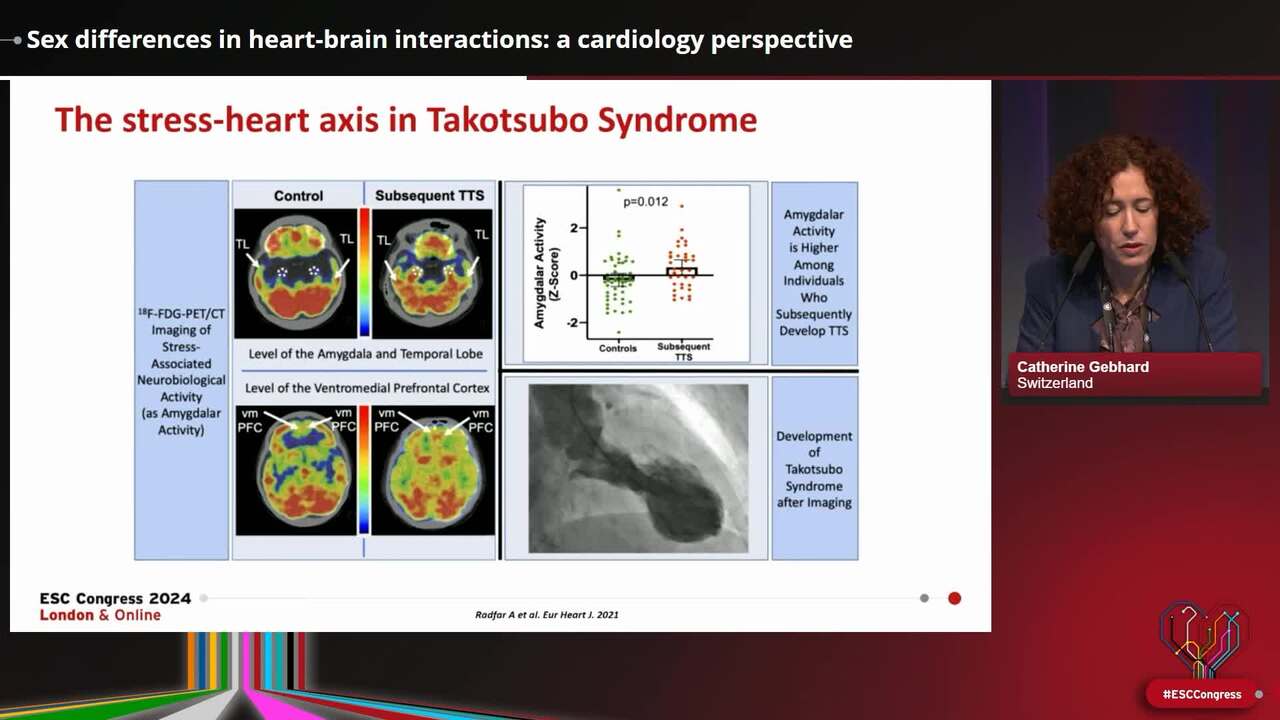Heart-brain interactions: sex differences and impact on cognition
