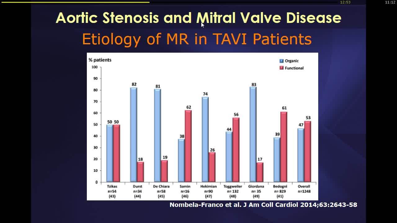 Imaging to guide TAVI.