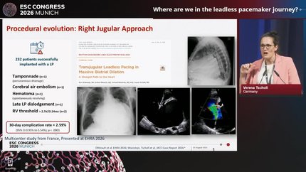 The next era of cardiac rhythm management: what is new in 2026?