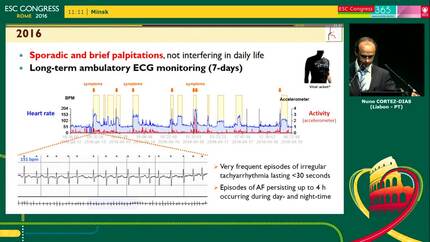 An atrial fibrillation patient who defies the latest guidelines - Clinical case