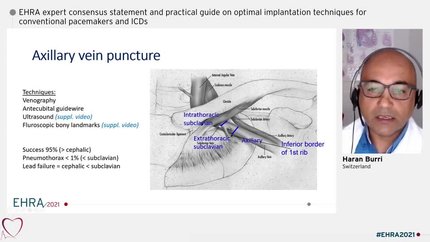 Presentation thumbnail