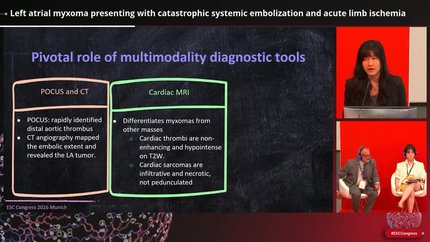Left atrial myxoma presenting with catastrophic systemic embolization and acute limb ischemia