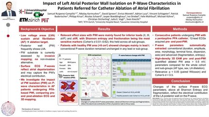 Impact of left atrial posterior wall isolation on the p wave characteristics in patients referred for catheter ablation of atrial fibrillation