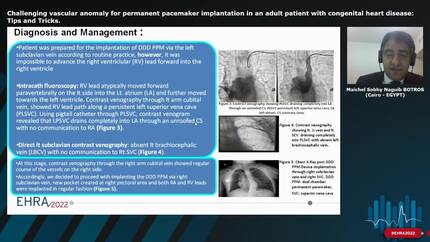 Challenging vascular anomaly for permanent pacemaker implantation in an adult patient with congenital heart disease: Tips and Tricks.