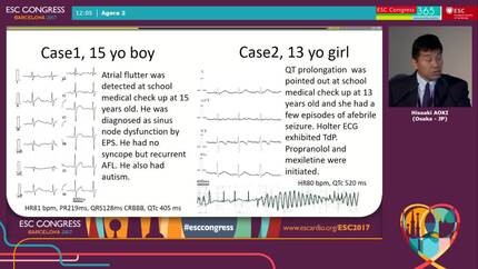 SCN10A mutations related with bradycardia and conduction block in young patients.