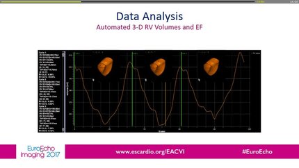 Why and how should we use 3D echo in: right heart disease.