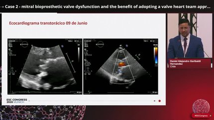 The impact of ESC guideline- implementation in the management of complex valvular heart disease: insights from Chile