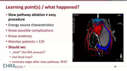 Supraventricular tachycardia (1)