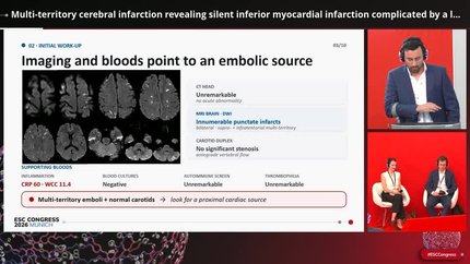 Multimodality imaging in acute coronary syndromes