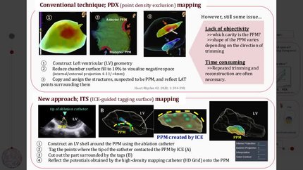Novel method for visualization of the papillary muscle using Ensite mapping system: intracardiac echography-guided tagging surface mapping
