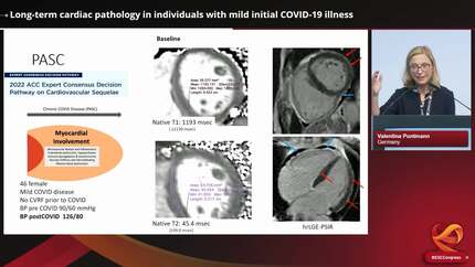 Presentation thumbnail