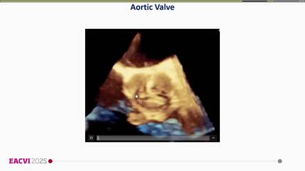 Presentation thumbnail