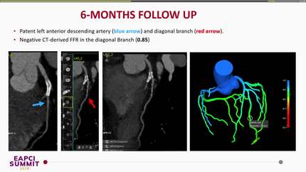 Presentation thumbnail