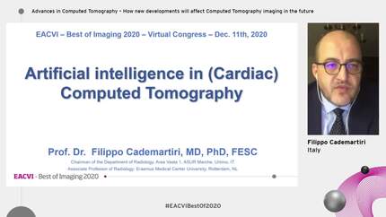 Advances in Computed Tomography – How new developments will affect Computed Tomography imaging in the future
