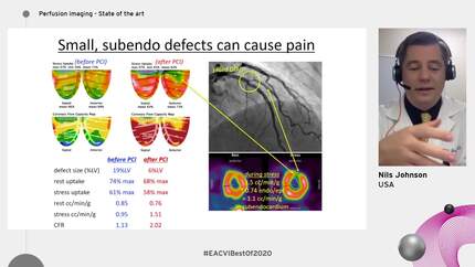 Presentation thumbnail