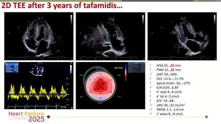 Presentation thumbnail