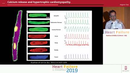 Calcium release and hypertrophic cardiomyopathy.