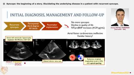 Syncope: the beginning of a story. Elucidating the underlying disease in a patient with recurrent syncope.