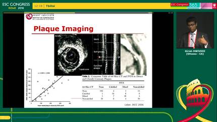 Cardiac CT as a screening tool for the detection of premature CAD in cardio oncology patients