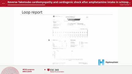 Reverse Takotsubo cardiomyopathy and cardiogenic shock after amphetamine intake in schizophrenic patient with loop recorder.