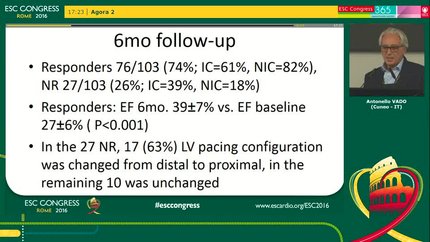 Response to cardiac resynchronization therapy with quadripolar lead - preliminary results of ResQ-CRT prospective study