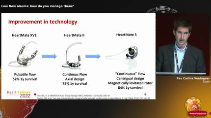 Low flow alarms: how do you manage them?