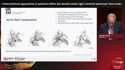 Double outlet right ventricle: a neglected condition with high clinical relevance