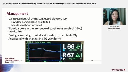 Use of novel neuromonitoring technologies in a contemporary cardiac intensive care unit.