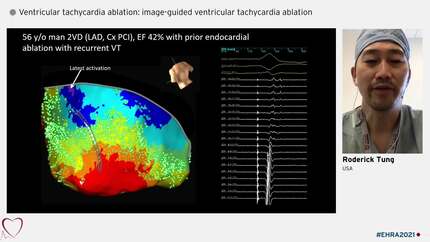 Identifying useful targets for ventricular tachycardia ablation