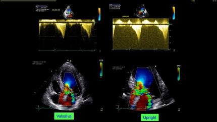 Presentation thumbnail
