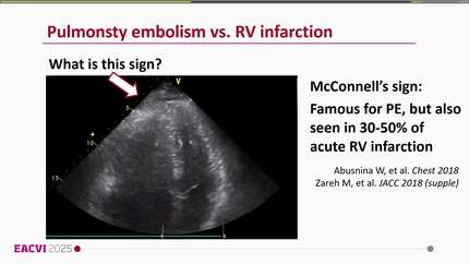 Presentation thumbnail