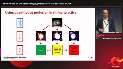 Angina with normal coronary arteries: do not forget microvascular disease